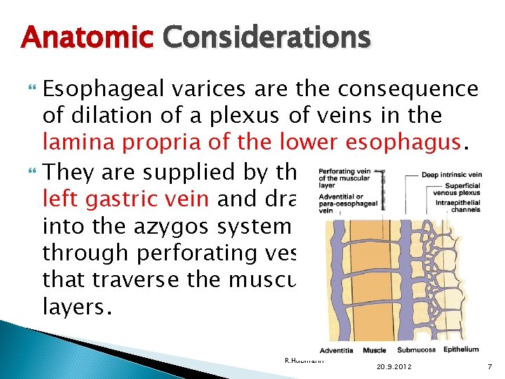 Anatomic Considerations Esophageal varices are the consequence of dilation of a plexus of veins