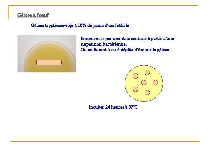 Gélose à l’oeuf Gélose trypticase-soja à 10% de jaune d’œuf stérile Ensemencer par une