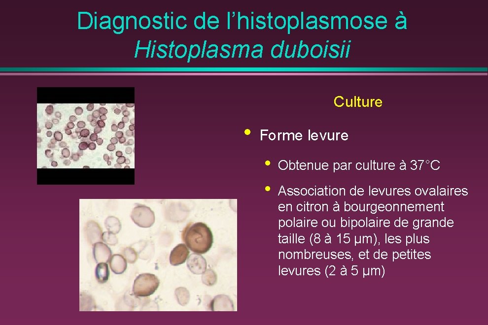 Diagnostic de l’histoplasmose à Histoplasma duboisii Culture • Forme levure • • Obtenue par