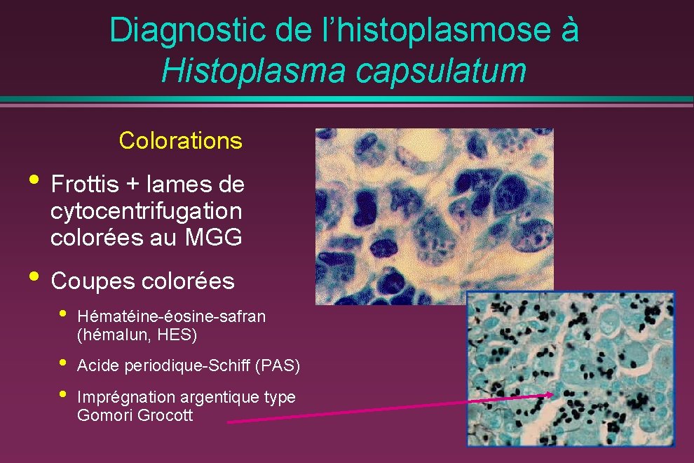 Diagnostic de l’histoplasmose à Histoplasma capsulatum Colorations • Frottis + lames de cytocentrifugation colorées