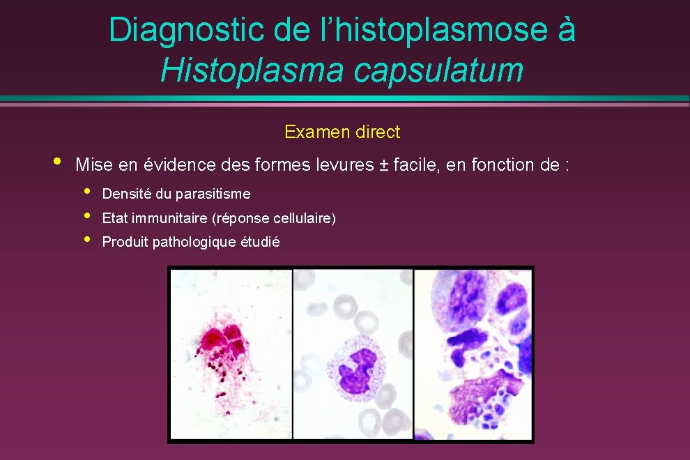 Diagnostic de l’histoplasmose à Histoplasma capsulatum Examen direct • Mise en évidence des formes