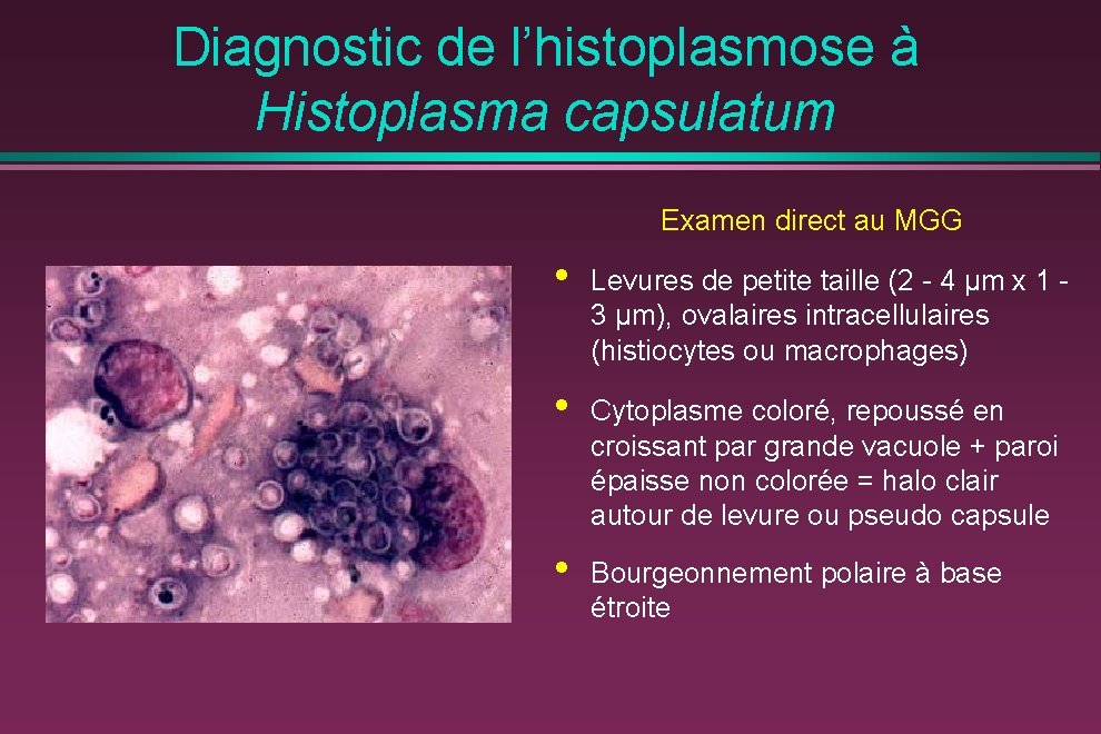 Diagnostic de l’histoplasmose à Histoplasma capsulatum Examen direct au MGG • Levures de petite