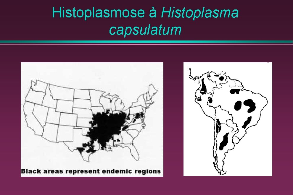 Histoplasmose à Histoplasma capsulatum 