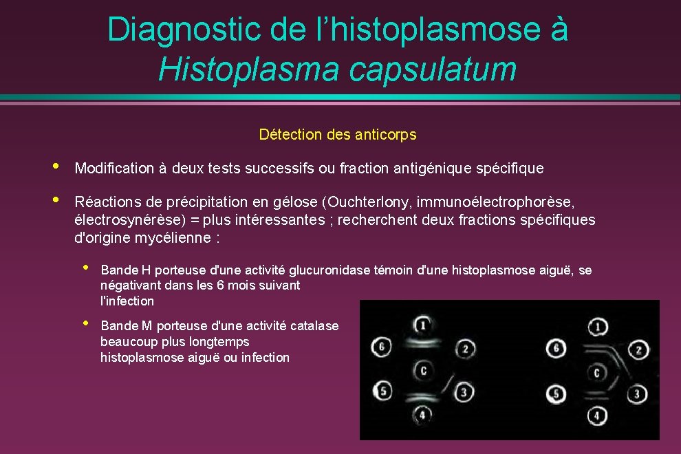 Diagnostic de l’histoplasmose à Histoplasma capsulatum Détection des anticorps • • Modification à deux
