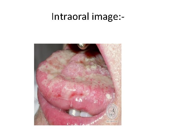 Intraoral image: - 