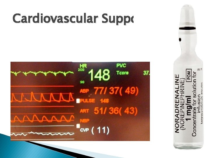 Cardiovascular Support 