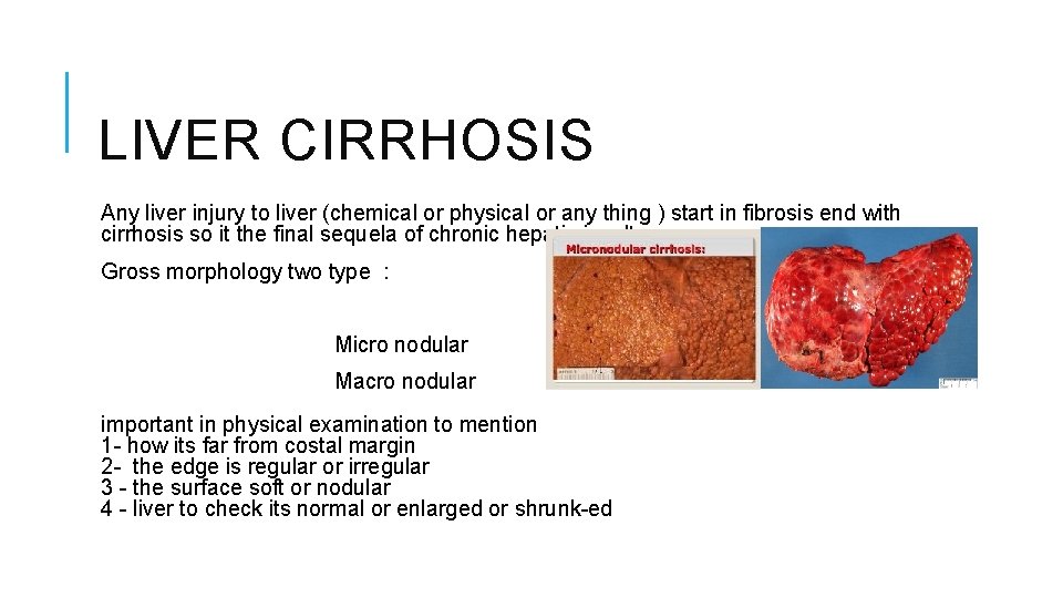 LIVER CIRRHOSIS Any liver injury to liver (chemical or physical or any thing )