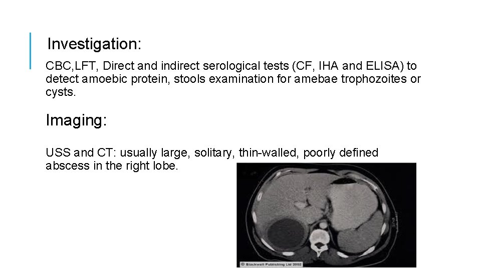 Investigation: CBC, LFT, Direct and indirect serological tests (CF, IHA and ELISA) to detect