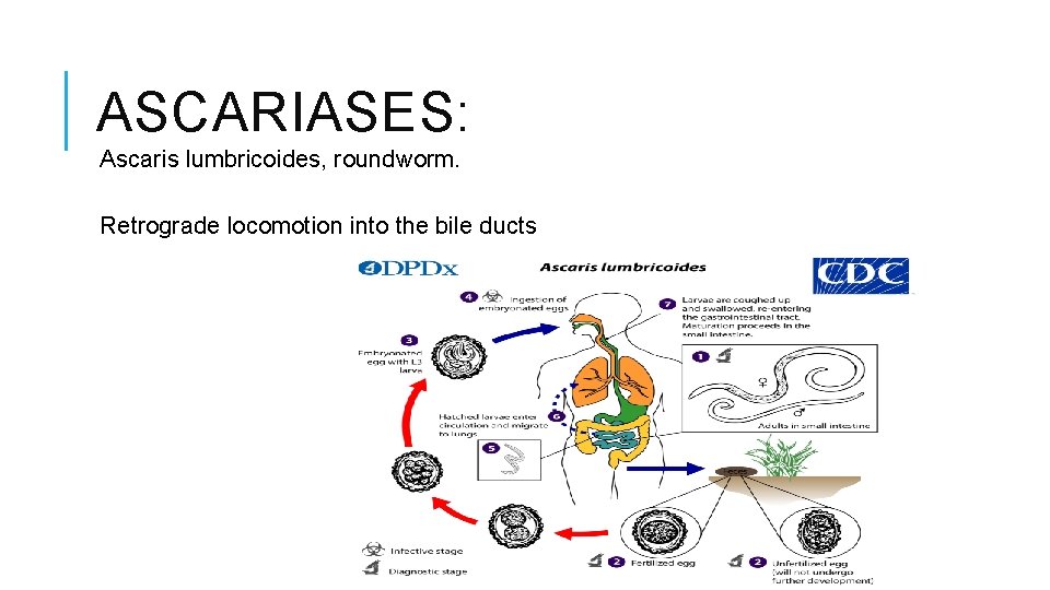 ASCARIASES: Ascaris lumbricoides, roundworm. Retrograde locomotion into the bile ducts 