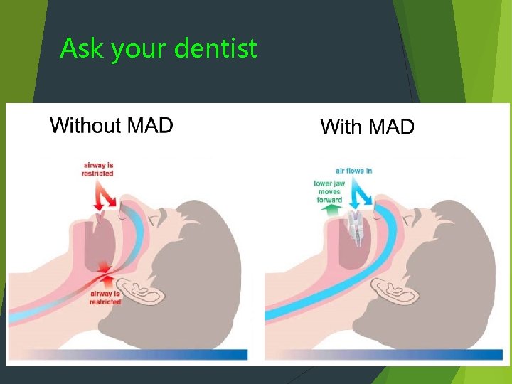 Ask your dentist 