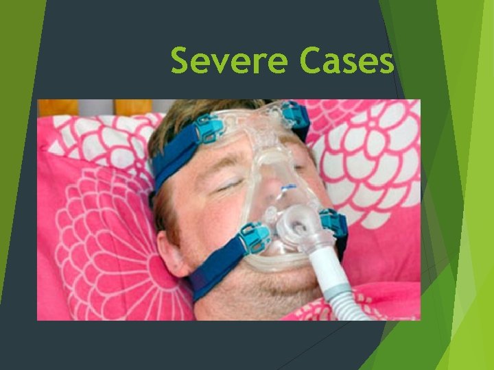 Severe Cases 