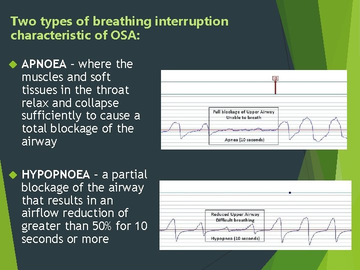 Two types of breathing interruption characteristic of OSA: APNOEA – where the muscles and