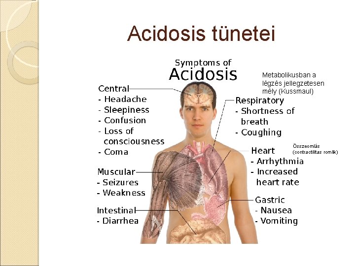 Acidosis tünetei Metabolikusban a légzés jellegzetesen mély (Kussmaul) Összeomlás (contractilitas romlik) 
