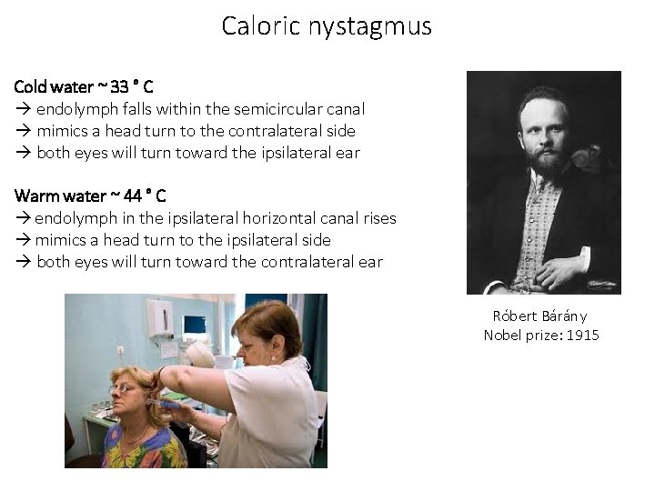 Caloric nystagmus Cold water ~ 33 ° C endolymph falls within the semicircular canal