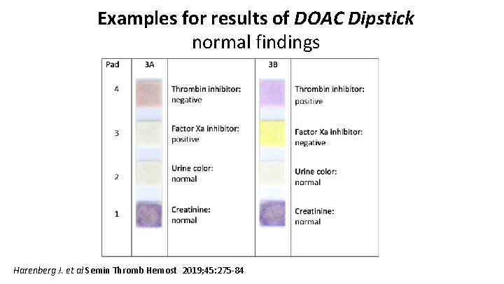 Examples for results of DOAC Dipstick normal findings Harenberg J. et al Semin Thromb