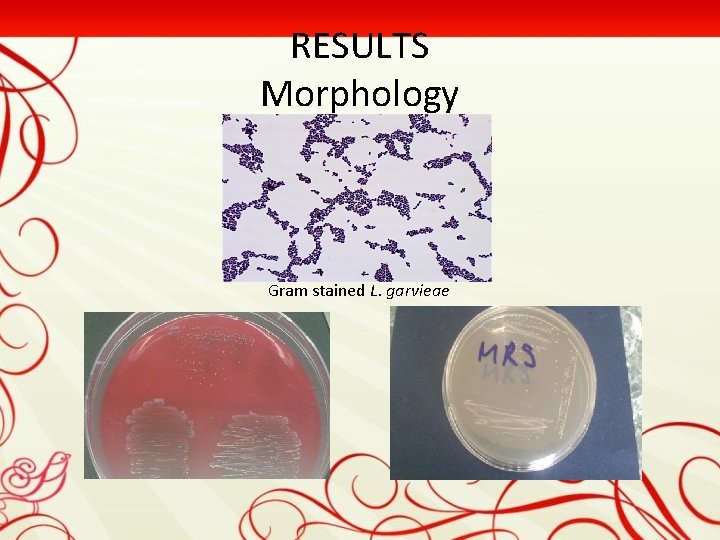 RESULTS Morphology Gram stained L. garvieae 