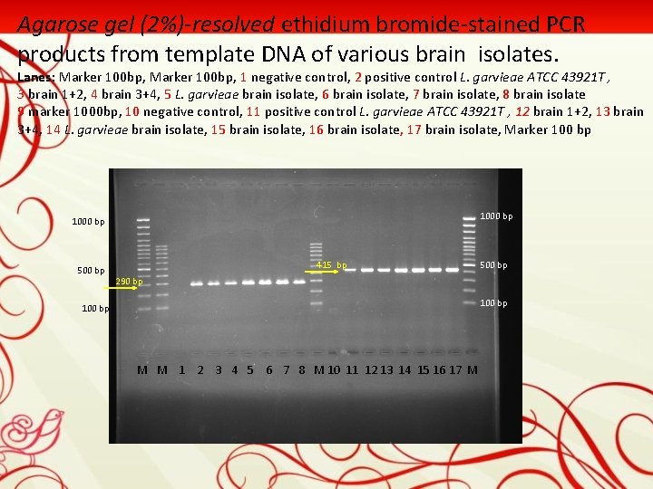 Agarose gel (2%)-resolved ethidium bromide-stained PCR products from template DNA of various brain isolates.