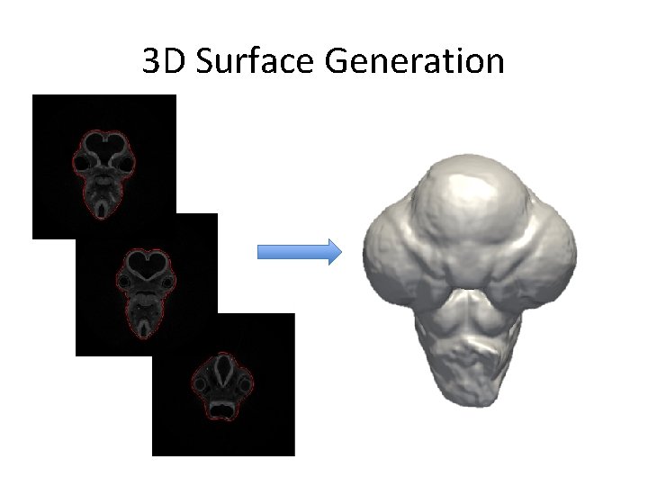 3 D Surface Generation 