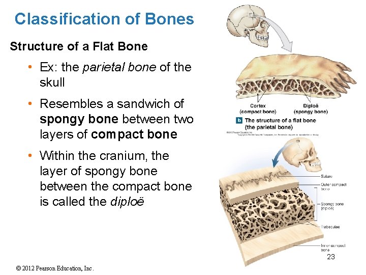 Classification of Bones Structure of a Flat Bone • Ex: the parietal bone of