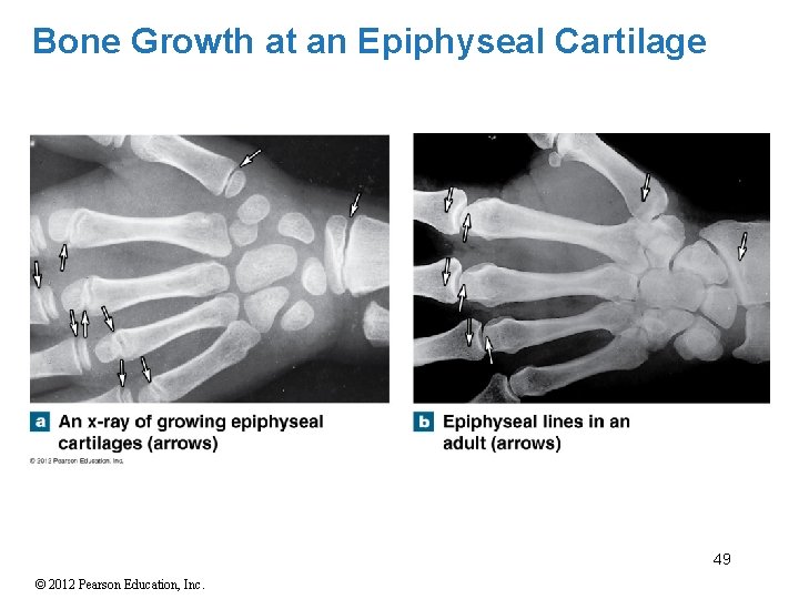 Bone Growth at an Epiphyseal Cartilage 49 © 2012 Pearson Education, Inc. 