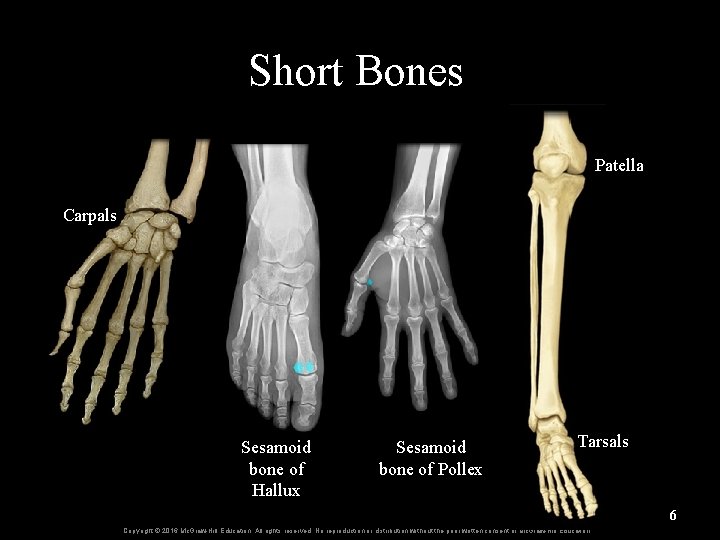 Short Bones Patella Carpals Sesamoid bone of Hallux Sesamoid bone of Pollex Tarsals 6