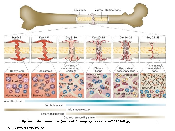 http: //www. nature. com/nrrheum/journal/v 11/n 1/images_article/nrrheum. 2014. 164 -f 2. jpg © 2012 Pearson