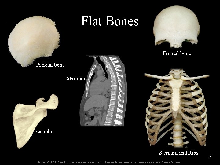 Flat Bones Frontal bone Parietal bone Sternum Scapula Sternum and Ribs Copyright © 2016