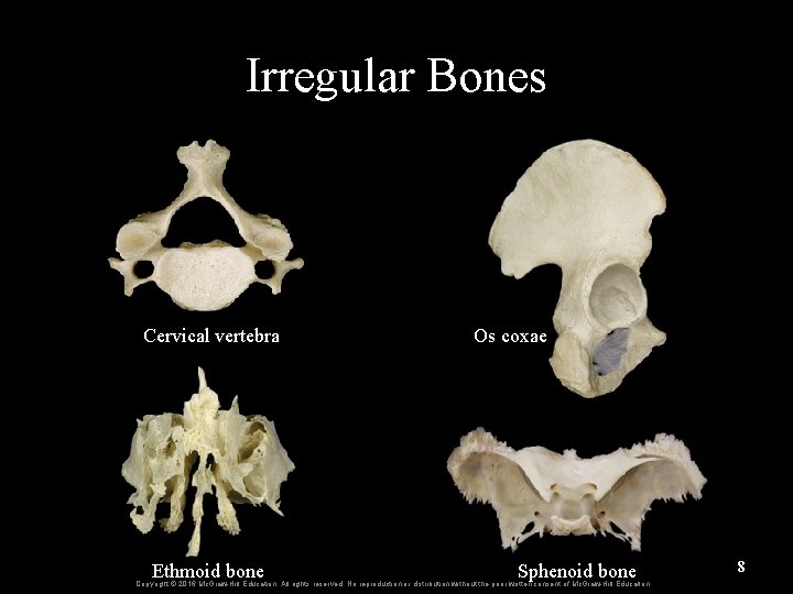 Irregular Bones Cervical vertebra Ethmoid bone Os coxae Sphenoid bone Copyright © 2016 Mc.