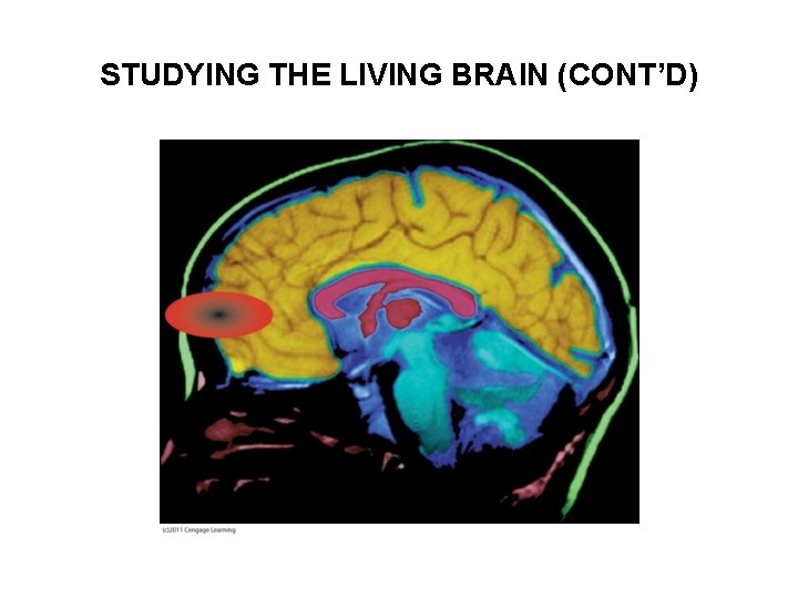 STUDYING THE LIVING BRAIN (CONT’D) 