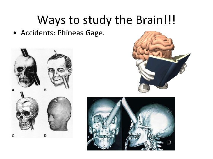 Ways to study the Brain!!! • Accidents: Phineas Gage. 