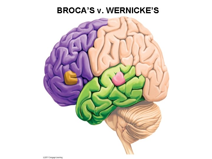 BROCA’S v. WERNICKE’S 