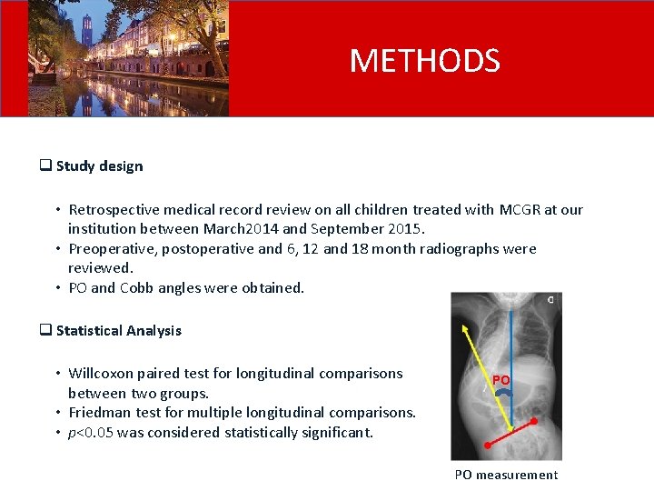 METHODS q Study design • Retrospective medical record review on all children treated with