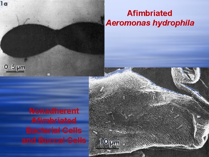 Afimbriated Aeromonas hydrophila Nonadherent Afimbriated Bacterial Cells and Buccal Cells 