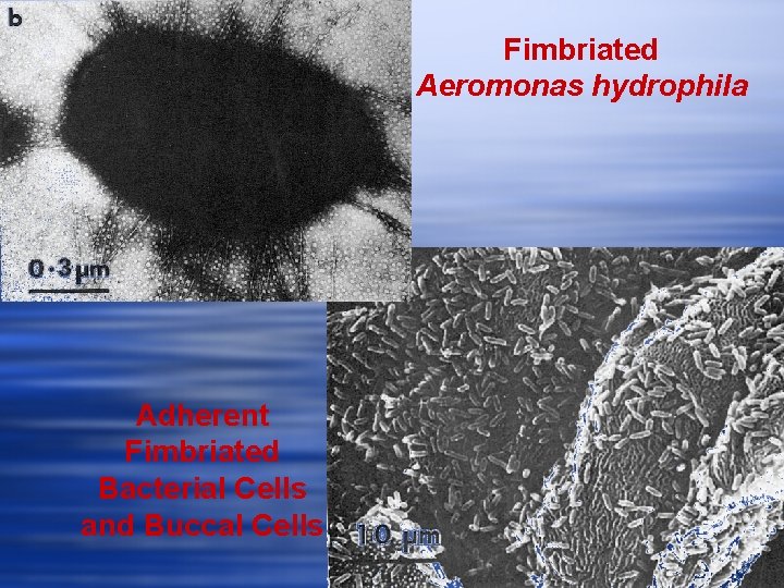 Fimbriated Aeromonas hydrophila Adherent Fimbriated Bacterial Cells and Buccal Cells 