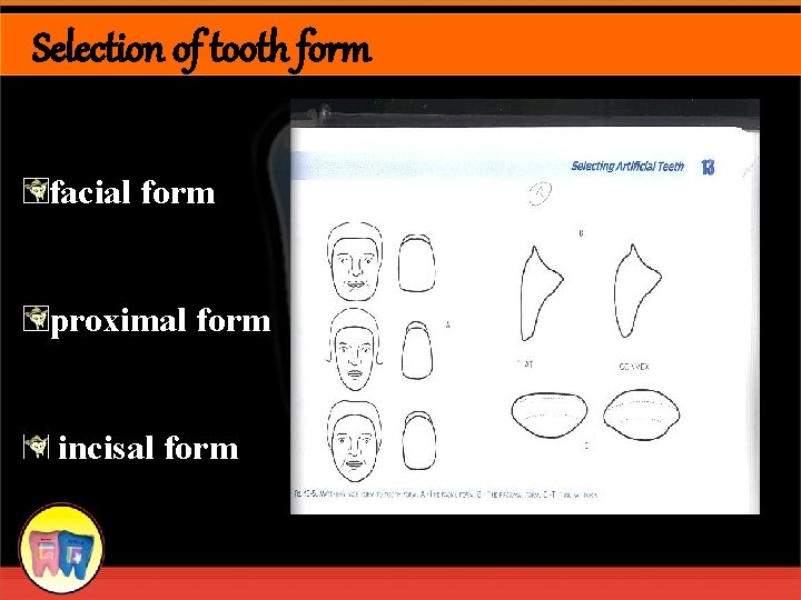 Selection of tooth form facial form proximal form incisal form 