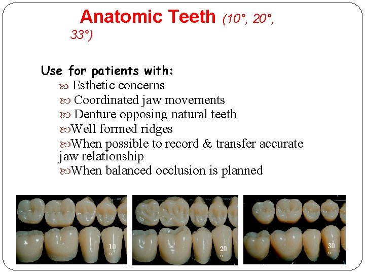Anatomic Teeth (10°, 20°, 33°) Use for patients with: Esthetic concerns Coordinated jaw movements