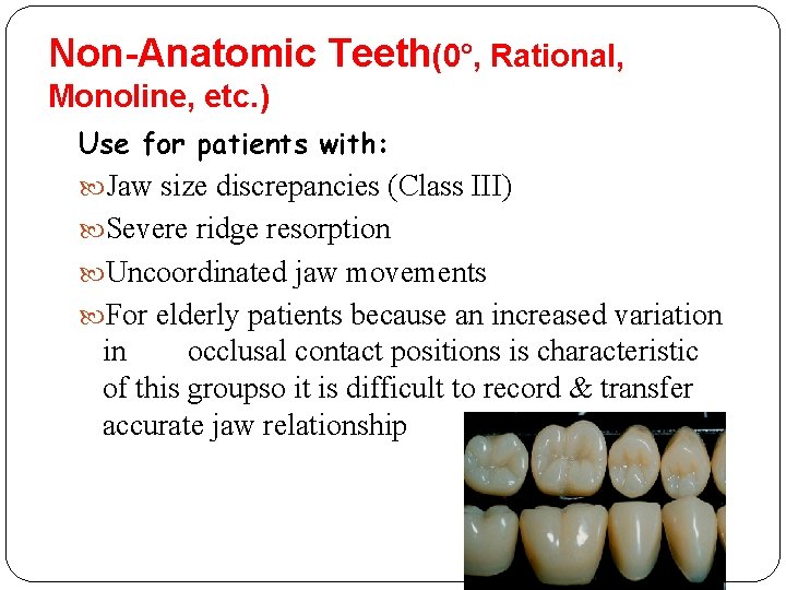 Non-Anatomic Teeth(0°, Rational, Monoline, etc. ) Use for patients with: Jaw size discrepancies (Class