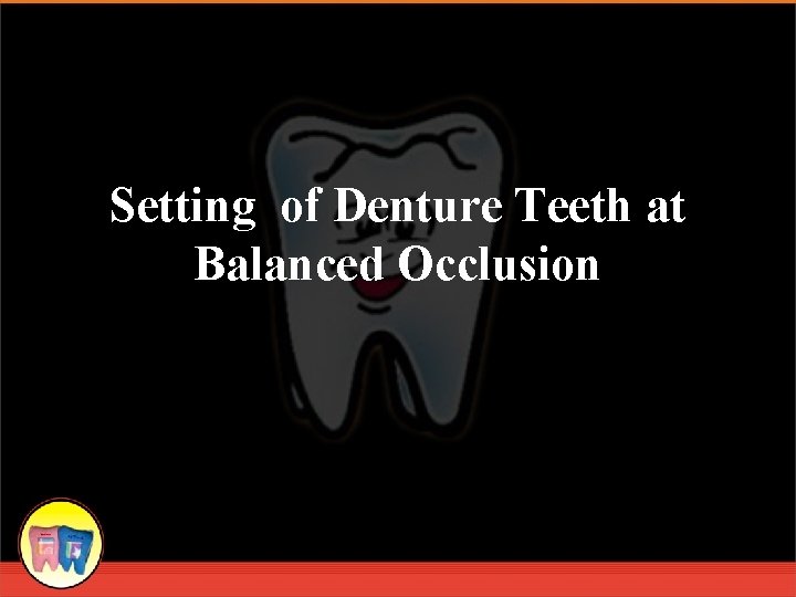 Setting of Denture Teeth at Balanced Occlusion 