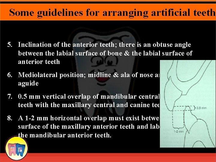 Some guidelines for arranging artificial teeth 5. Inclination of the anterior teeth; there is