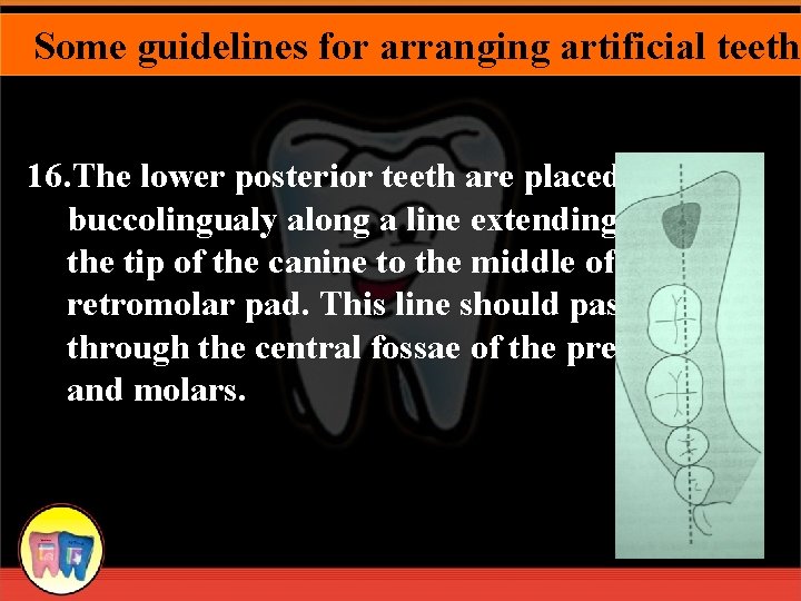 Some guidelines for arranging artificial teeth 16. The lower posterior teeth are placed buccolingualy