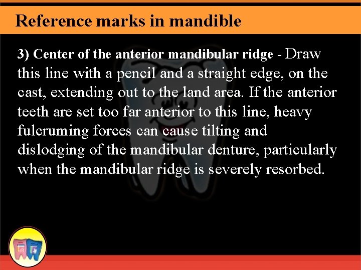 Reference marks in mandible 3) Center of the anterior mandibular ridge - Draw this