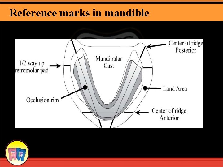 Reference marks in mandible 