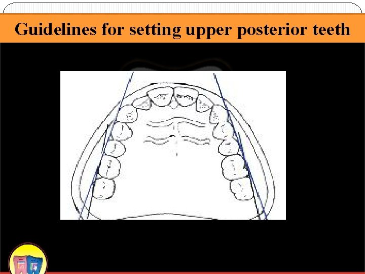 Guidelines for setting upper posterior teeth 