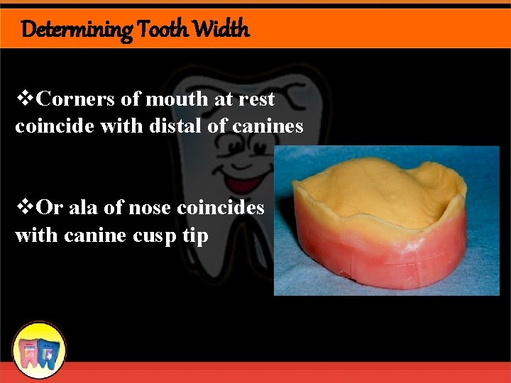 Determining Tooth Width v. Corners of mouth at rest coincide with distal of canines
