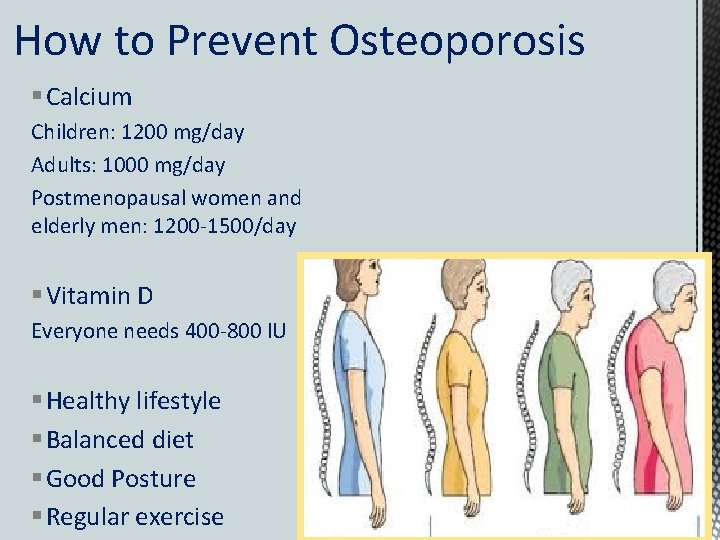 How to Prevent Osteoporosis § Calcium Children: 1200 mg/day Adults: 1000 mg/day Postmenopausal women