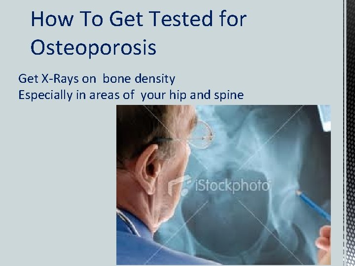 How To Get Tested for Osteoporosis Get X-Rays on bone density Especially in areas