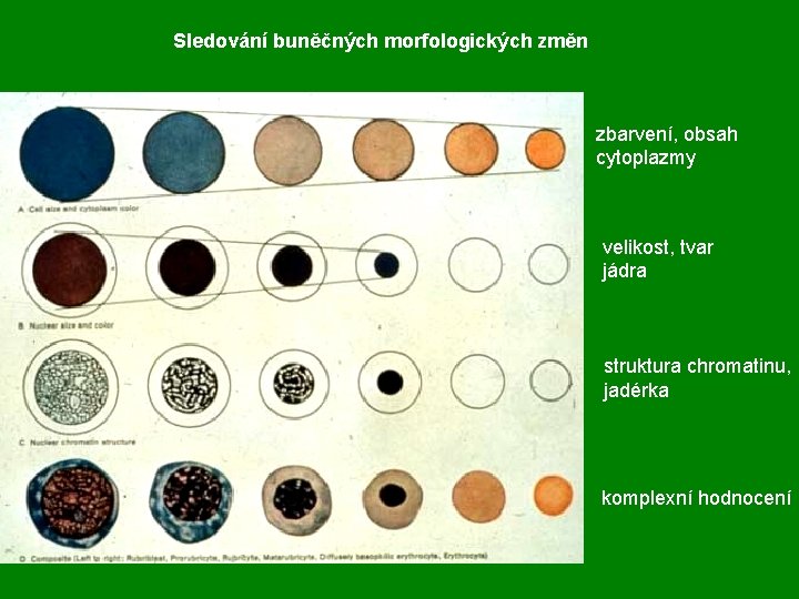 Sledování buněčných morfologických změn zbarvení, obsah cytoplazmy velikost, tvar jádra struktura chromatinu, jadérka komplexní
