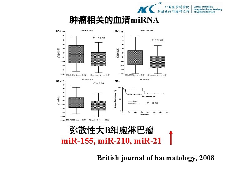 肿瘤相关的血清mi. RNA 弥散性大B细胞淋巴瘤 mi. R-155, mi. R-210, mi. R-21 British journal of haematology, 2008