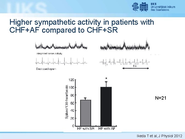 Higher sympathetic activity in patients with CHF+AF compared to CHF+SR N=21 Ikeda T et