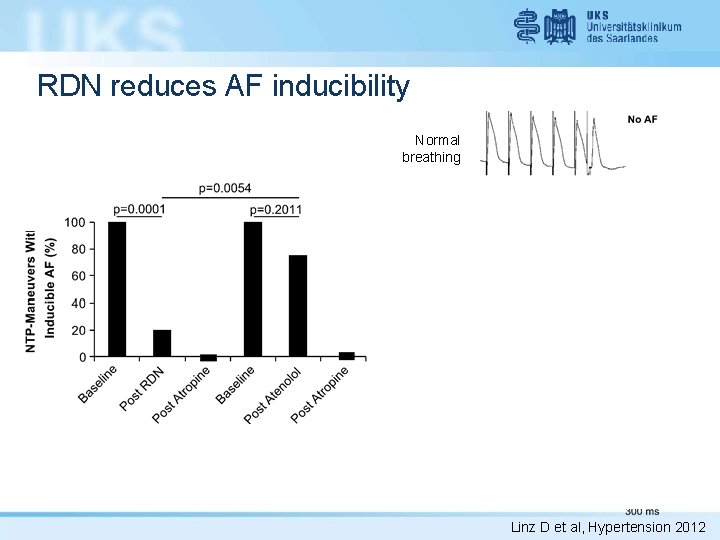 RDN reduces AF inducibility Normal breathing 2 -min of NTP at -80 mbar after